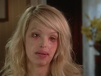 Katie Piper Shares Hopes for Future