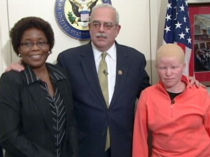 VIDEO: After gruesome attack, Mariamu Staford helps raise awareness on albino killings.