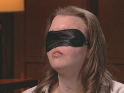 Blind Love: The Life of Chrissy Steltz