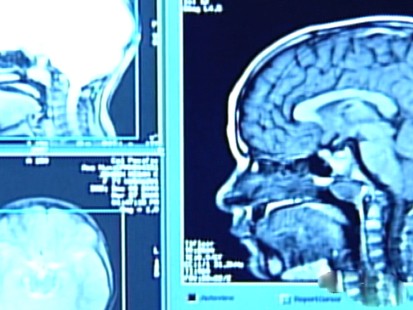 brain