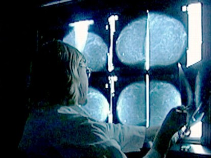 VIDEO: Study finds mammograms between ages 40-49 reduces breast cancer risk 26 percent.