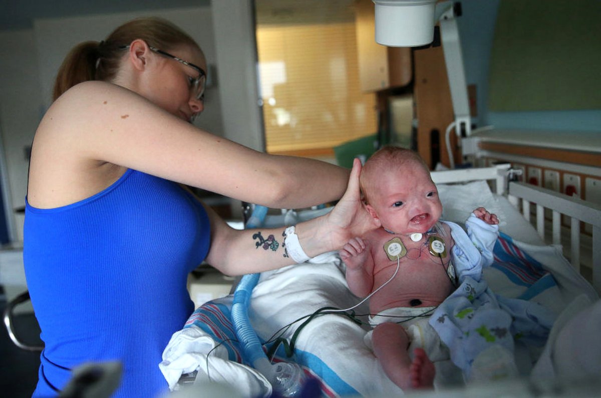 PHOTO: After a tracheostomy, Eli is able to breath on his own better than before. 