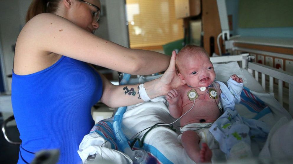 PHOTO: After a tracheostomy, Eli is able to breath on his own better than before. 