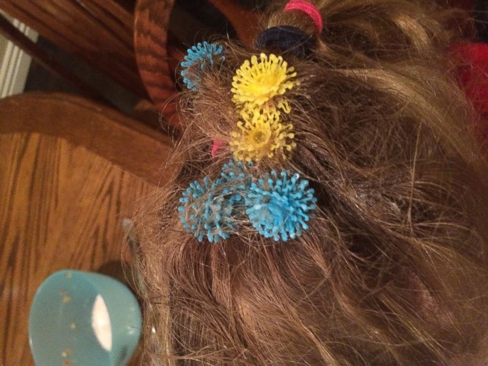 Toy Warning: 'Bunchems' Ruins Kid's Hair