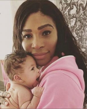 VIDEO: Even 23-time Grand Slam singles champion Serena Williams was at a loss over how to help her baby, Alexis, through teething pain.