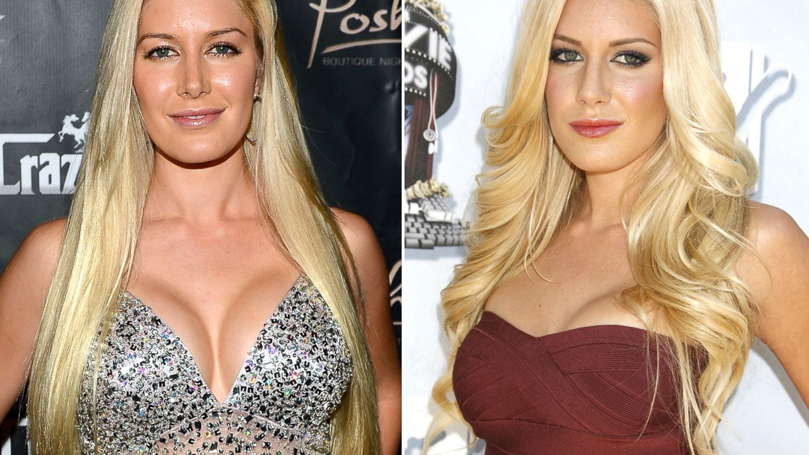 Heidi Montag and Other Downsizing Celebrities - ABC News