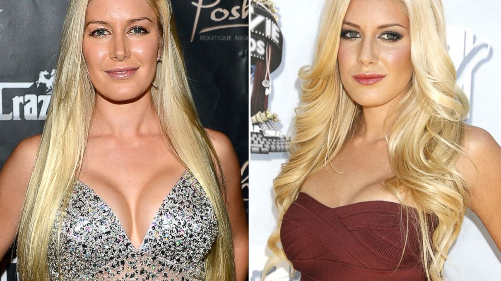 This combination of Aug. 31, 2013 and June 1, 2008 photos shows Heidi Montag, left, at the Crazy Horse III Gentlemen's Club to celebrate Spencer Pratt's 30th birthday in Las Vegas and, right, five years ago at the 2008 MTV Movie Awards in Universal City, Calif.