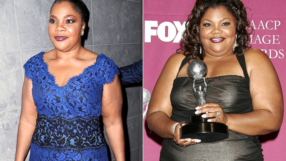 10 Craziest Celebrity Weight Loss Journeys