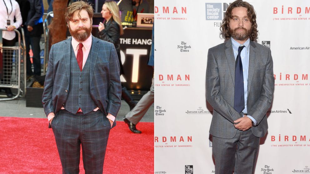 The Zach Galifianakis Weight Loss Story – Avoid Weight-Loss Sagging