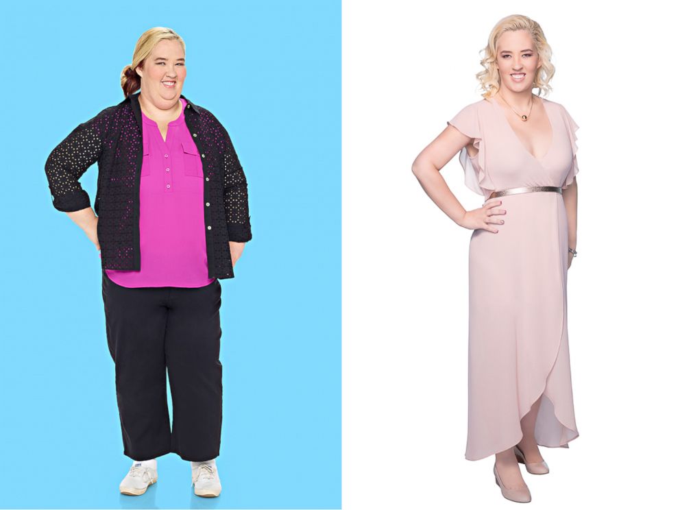 PHOTO: Reality TV star Mama June Shannon reveals she lost 300 pounds after gastric sleeve surgery and other procedures.