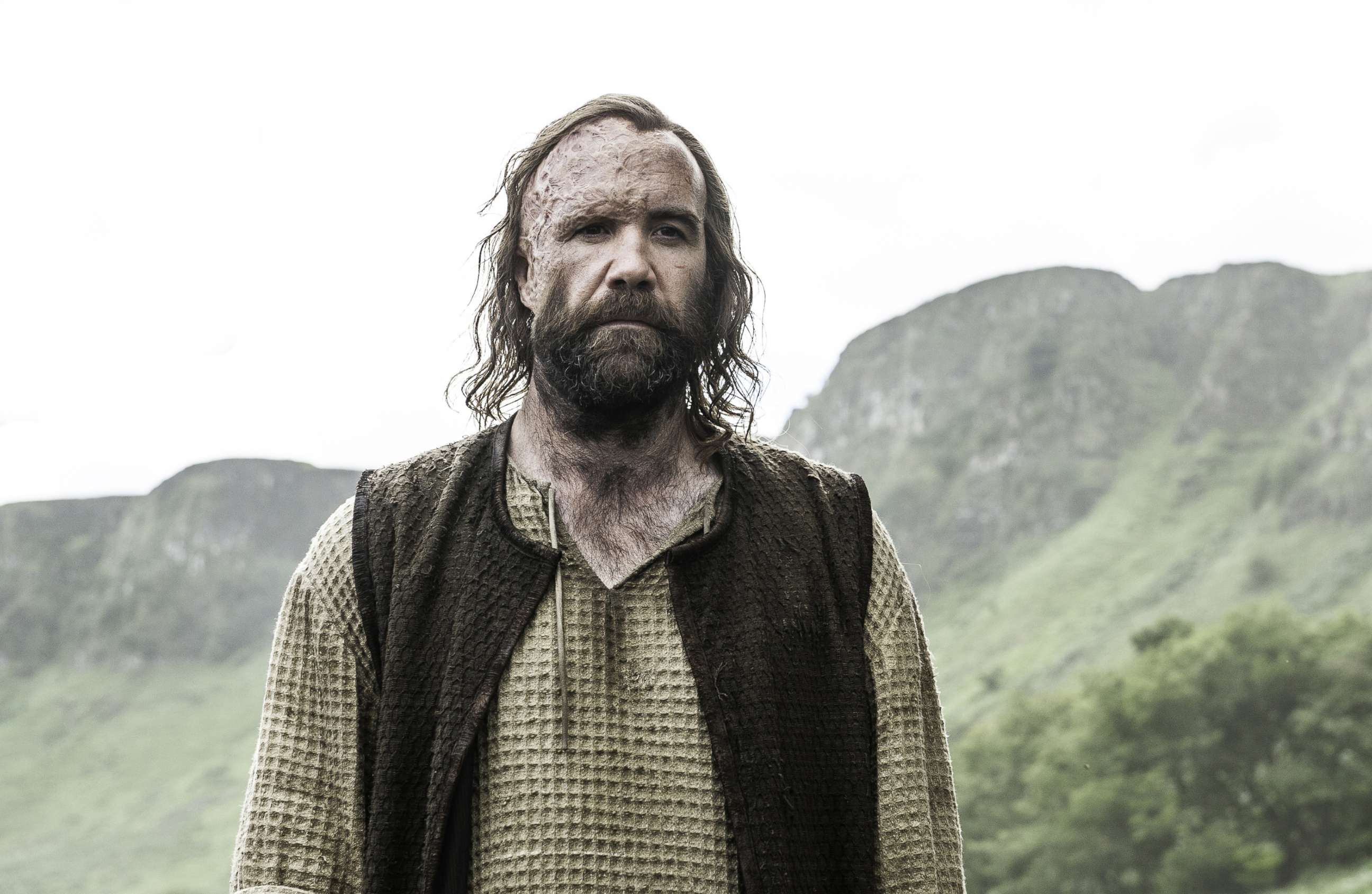 PHOTO: Rory McCann as Sandor Clegane in the "Game of Thrones."