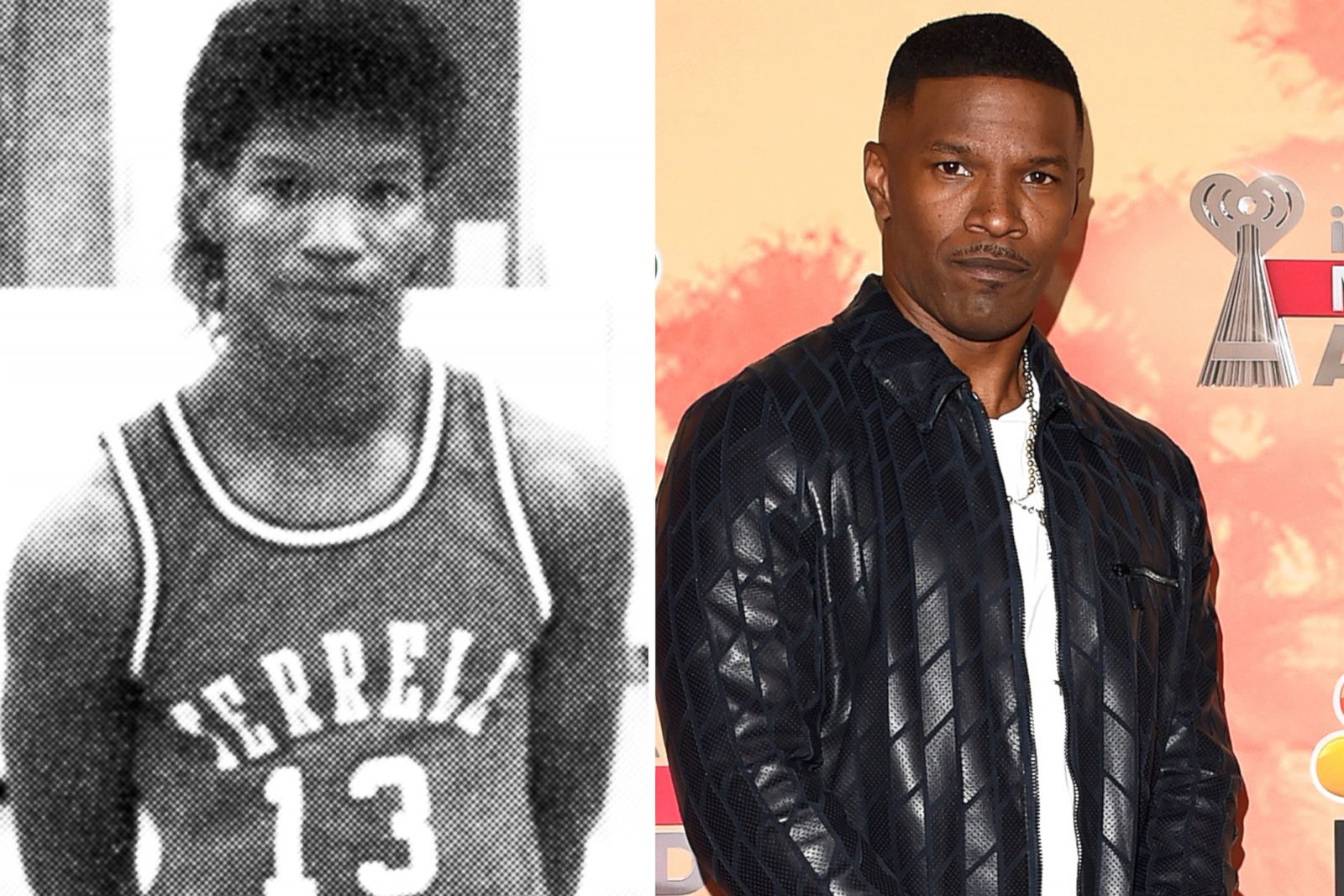 Jamie Foxx Hairline Surgery Before And After Photos