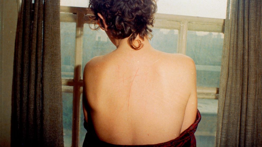 This image released by Neon shows Nan Goldin in 1978, an image used for the documentary "All the Beauty and the Bloodshed." (Nan Goldin/Neon via AP)