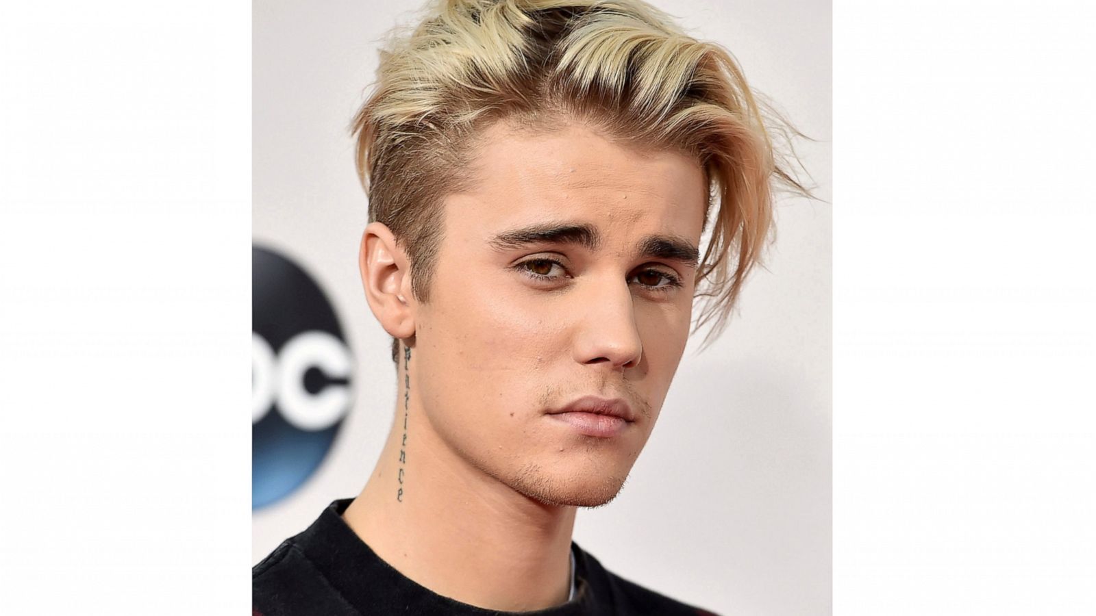 Justin Bieber Says He S Battling Lyme Disease Abc News