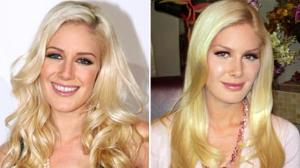 Heidi Montag and Other Downsizing Celebrities - ABC News