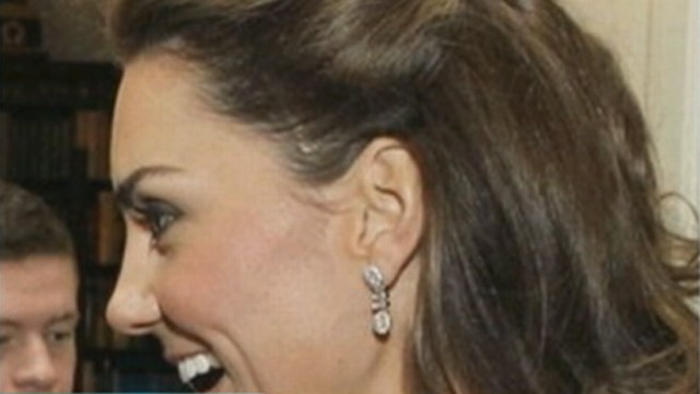 VIDEO: Duchess of Cambridge has a three-inch scar related to a childhood operation.