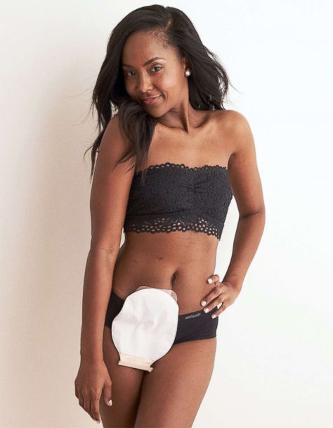 Aerie brings inclusive model casting to a new level - Good Morning America