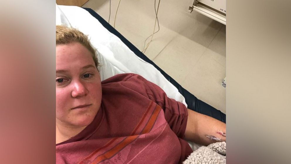 Amy Schumer posted this photo to her Instagram account @amyschumer of her in the hospital with a kidney infection, April 27, 2018.