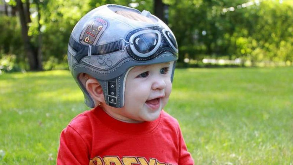 7-month-old Brendan Davis, who was diagnosed with plagiocephaly, wears a "Back to the Future"-themed helmet created by Paula Strawn.