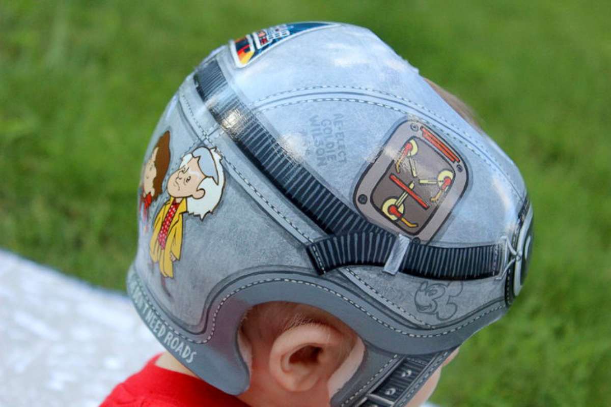 PHOTO: 7-month-old Brendan Davis, who was diagnosed with plagiocephaly, wears a "Back to the Future"-themed helmet created by Paula Strawn.