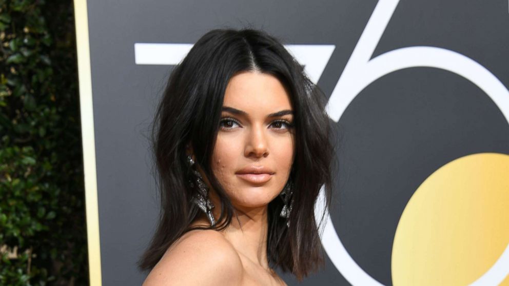 Kendall Jenner Opens Up About Anxiety Sometimes Its Out Of Your Control