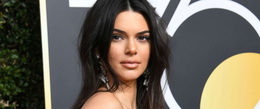 Kendall Jenner Opens Up About Anxiety Sometimes Its Out Of Your Control