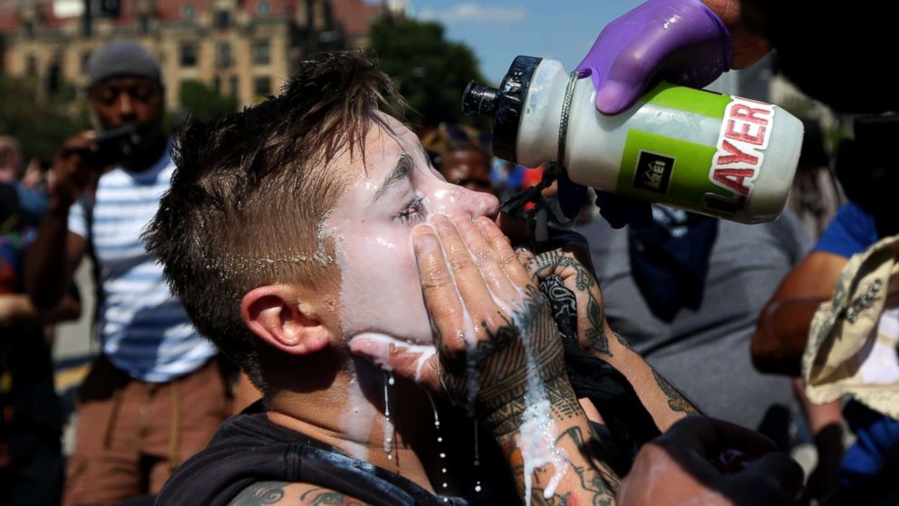 PHOTO: "The boxed us in and started peppy spraying us," said Mackenzie Marks of St. Louis, who her eyes washed out after being pepper spray protesting the not guilty verdict in the killing of Anthony Lamar Smith, Sept. 15, 2017.