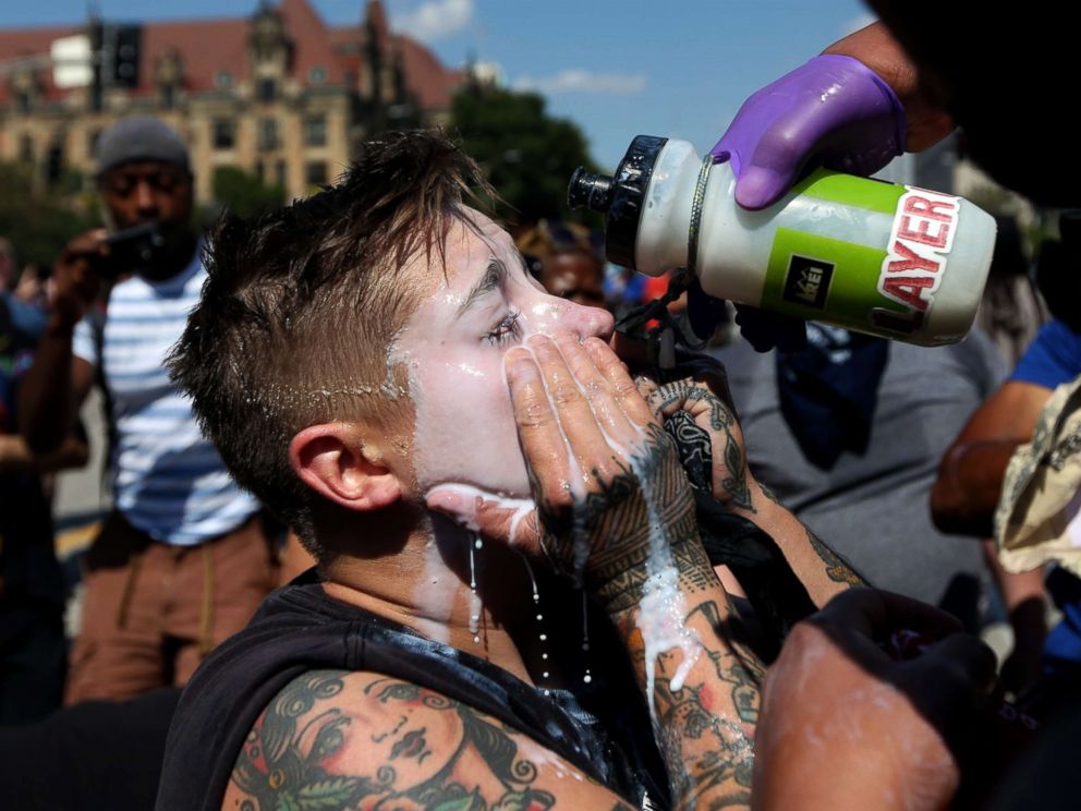 PHOTO: "The boxed us in and started peppy spraying us," said Mackenzie Marks of St. Louis, who her eyes washed out after being pepper spray protesting the not guilty verdict in the killing of Anthony Lamar Smith, Sept. 15, 2017.