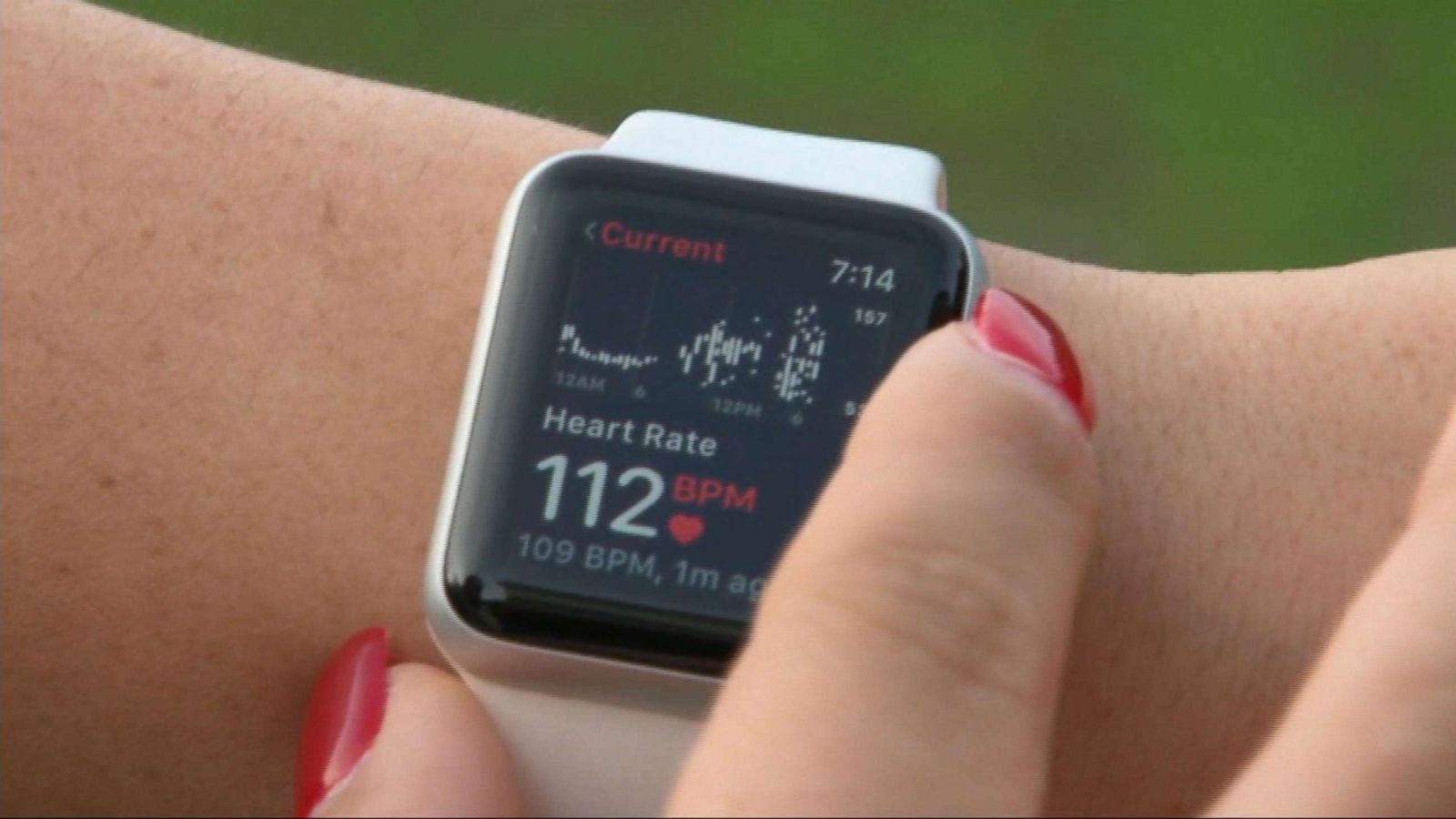 PHOTO: Deanna Recktenwald checks her apple watch after it recently sent her an alert that saved her life.