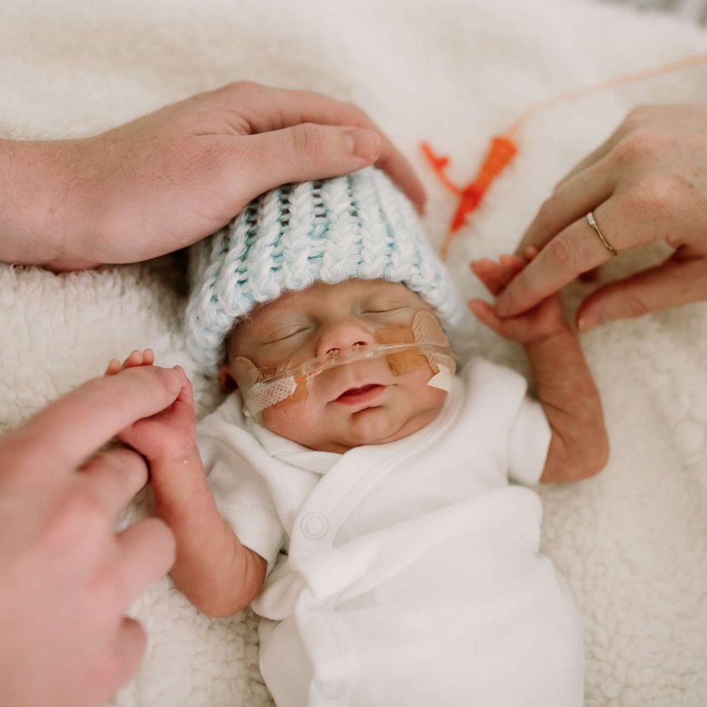 VIDEO: 1-pound preemie who fought 100 days in NICU heads home after remarkable recovery 
