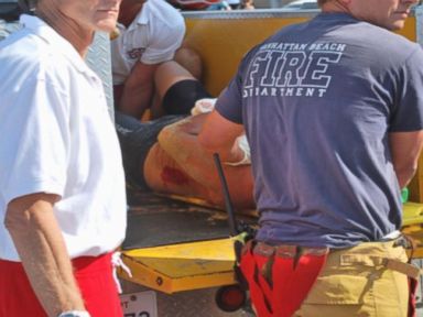 VIDEO: Swimmer Describes Great White Shark Attack Off LA's Manhattan Beach