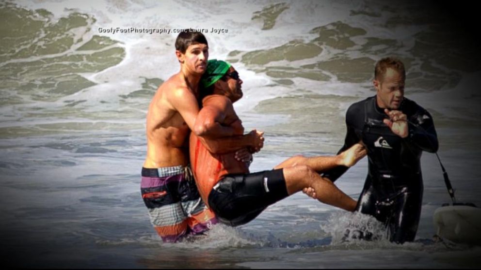 California Shark Attack Surfer Relives Harrowing Attack Good Morning   140707 Gma Sharks1 16x9 992 