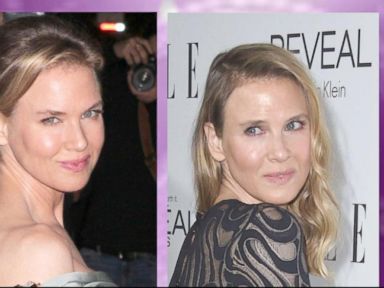 VIDEO: Renee Zellweger Glad People Are Noticing New Look