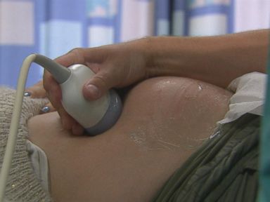 VIDEO: Heart Disease Is Leading Cause of Pregnancy-Related Deaths