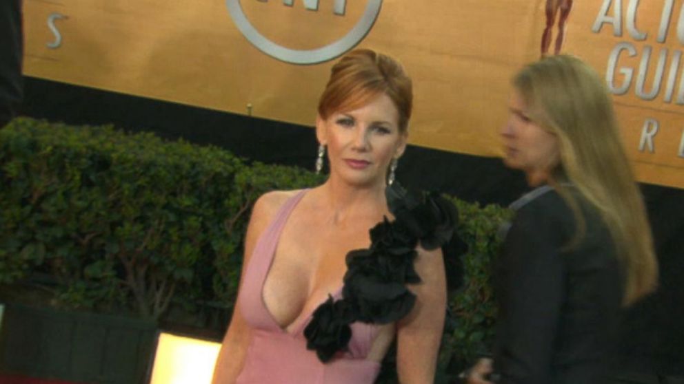 Tits melissa gilbert 59 Celebrities