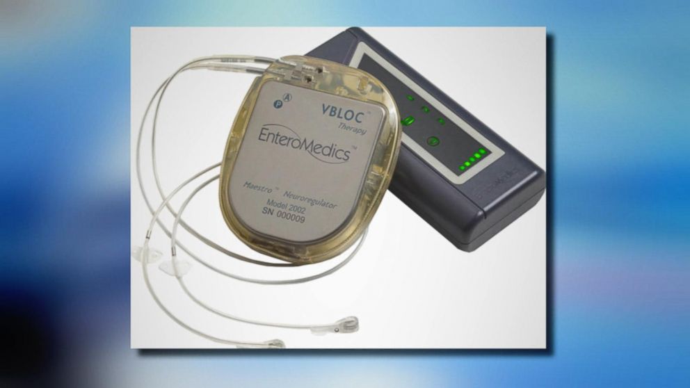 FDA Approves New WeightLoss Device Video ABC News