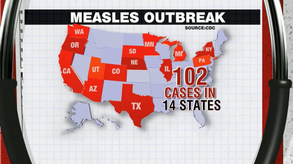 The Outbreak Of Measles Outbreak