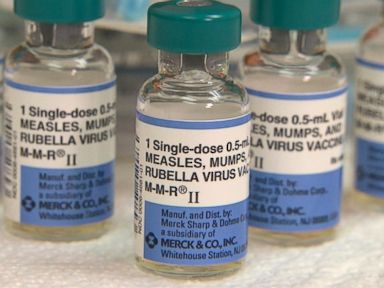 VIDEO: Chicago-Area Day Care Says 5 Infants Diagnosed With Measles