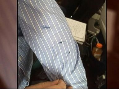 VIDEO: Snoring Man Stabbed With a Pen on Plane by Irate Passenger