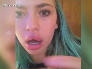 VIDEO: The Dangerous 'Kylie Jenner Challenge' Exploding Online