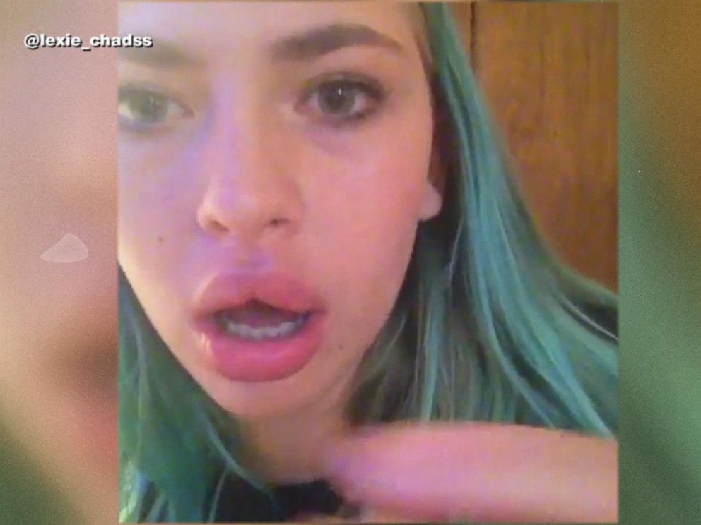 Home plumped teens videos picture 517