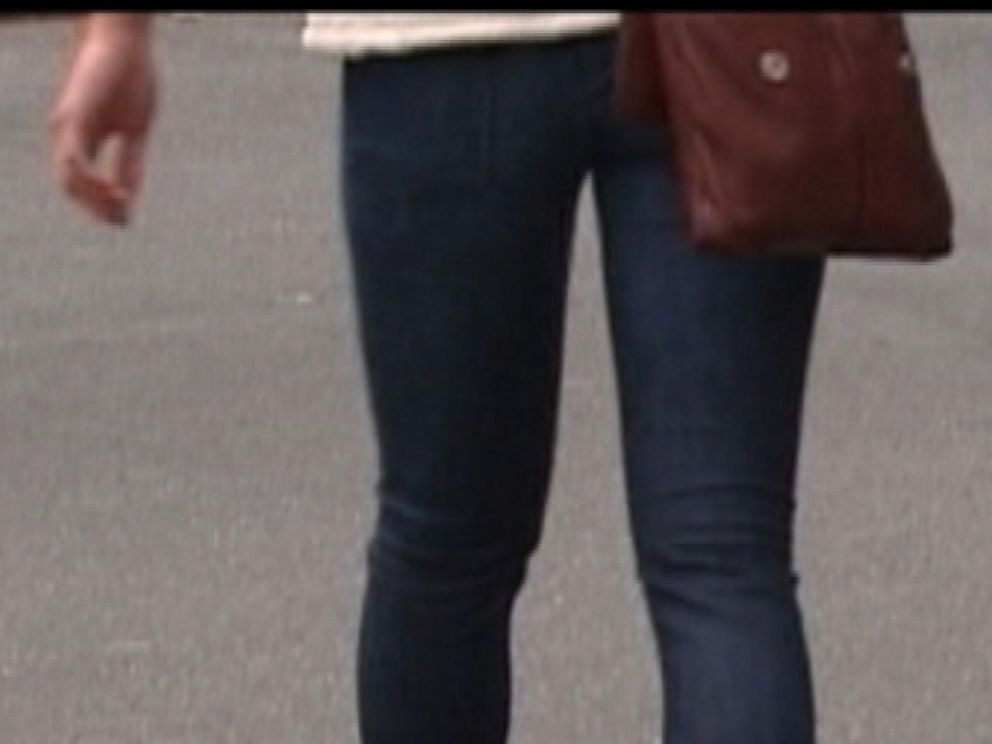 Fashion Victim In Tight Pants Experiences Nerve And Muscle Damage: Medical  Conditions Caused By Skinny Jeans