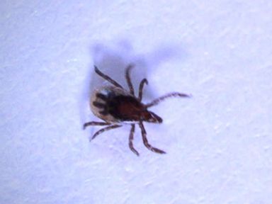 VIDEO: How Parents Can Protect Kids From Ticks