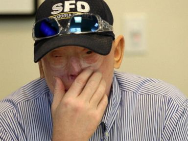 VIDEO: Face Transplant Surgery Gives Former Firefighter a New Face 