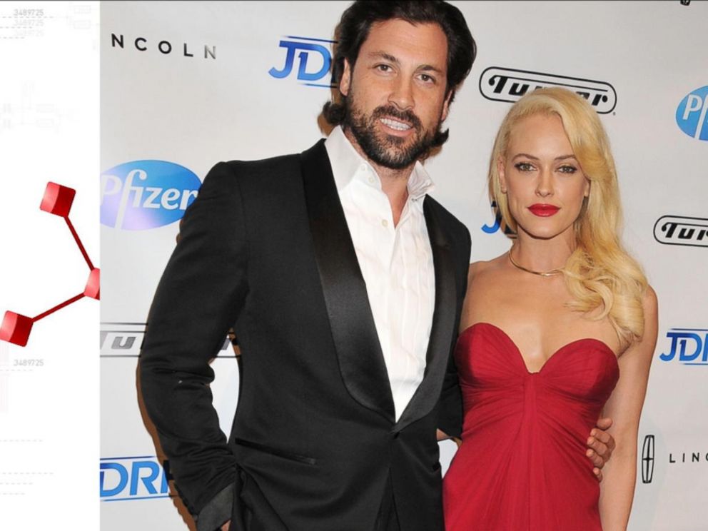 Maksim Chmerkovskiy And Peta Murgatroyd Are Expecting Their 1st Child Abc News