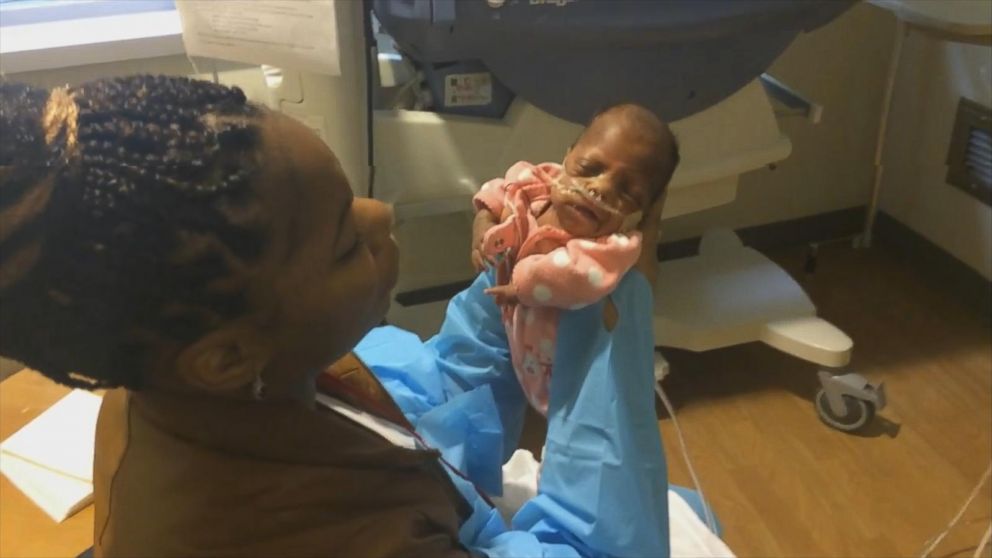 Hospital Celebrates 'One of World's Smallest Babies Ever ...