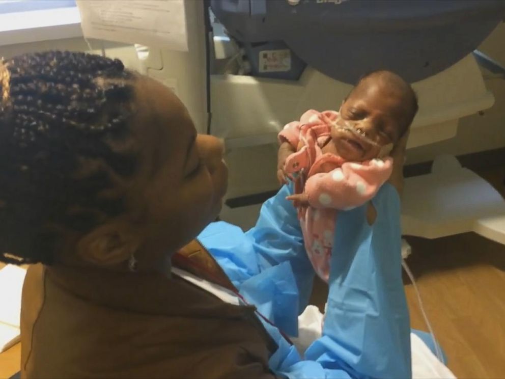 World's smallest surviving baby, born at .5 pounds, goes home 5