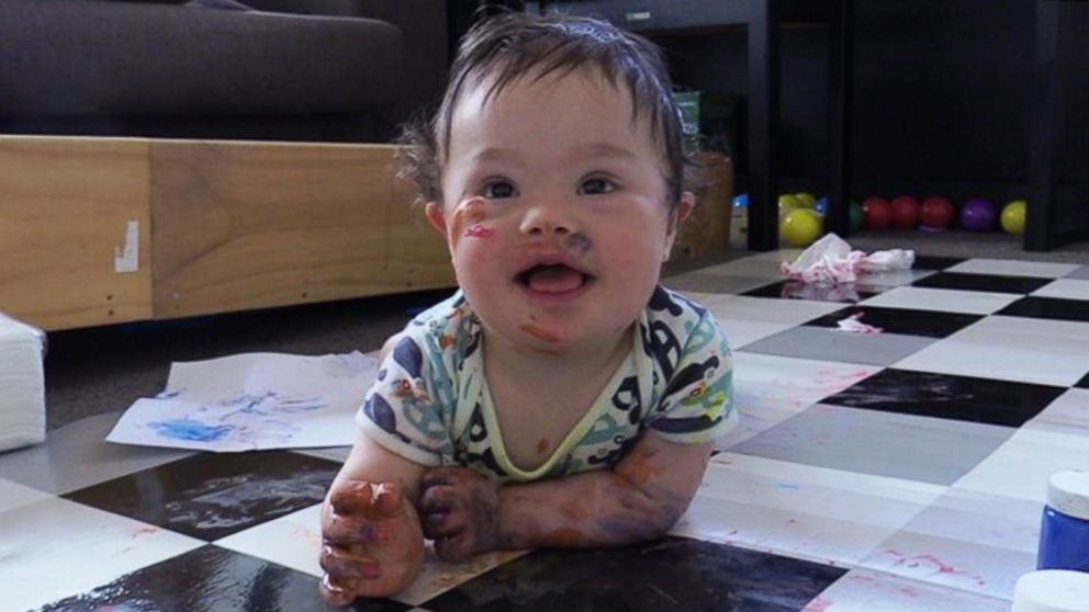 Down Syndrome Families Speak Out About Their Experience