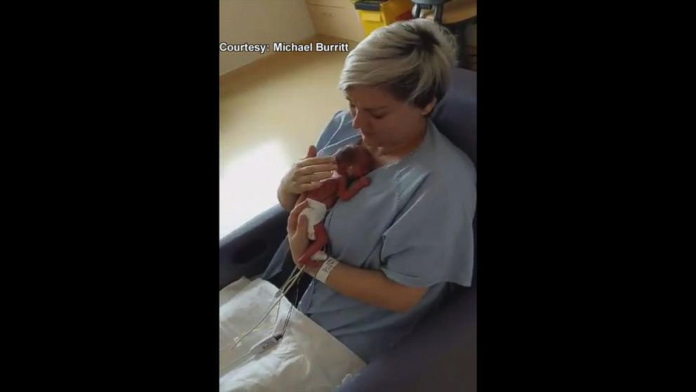 Mom Holds Premature Son For First Time Nearly 60 Hours After Birth