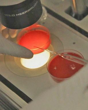 VIDEO: New Fertility Procedure Could Mean an End to Expensive IVF Treatments